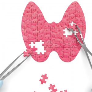 Troid, Hipertiriodizm Nasıl İyileşir?