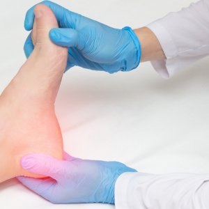 Topuk Dikeni İçin Bitkisel Yöntemler