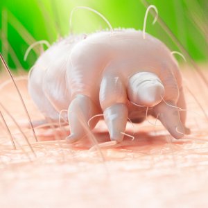 Uyuz Neden Olur, Nasıl Bulaşır?