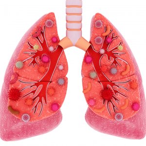 Akciğer Nasıl İyileşir?