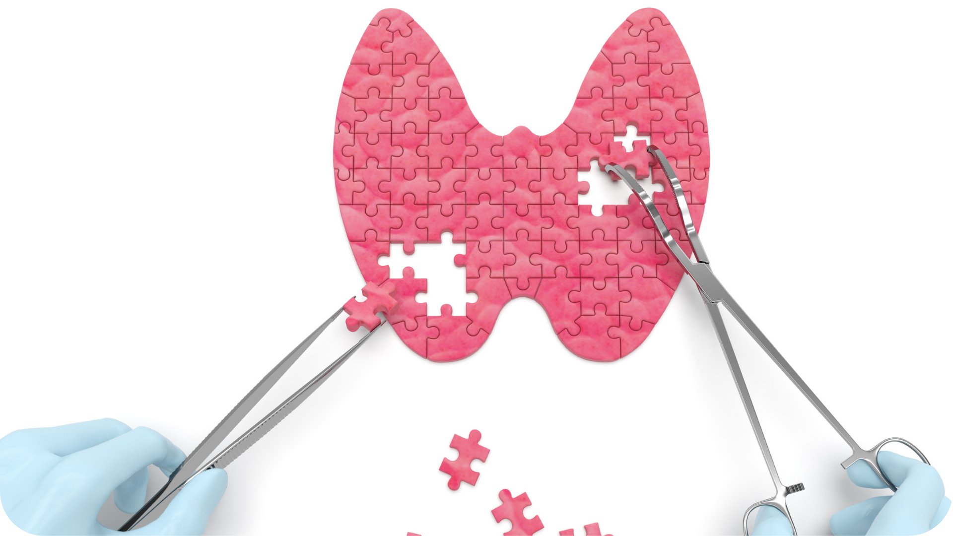 Troid, Hipertiriodizm Nasıl İyileşir?