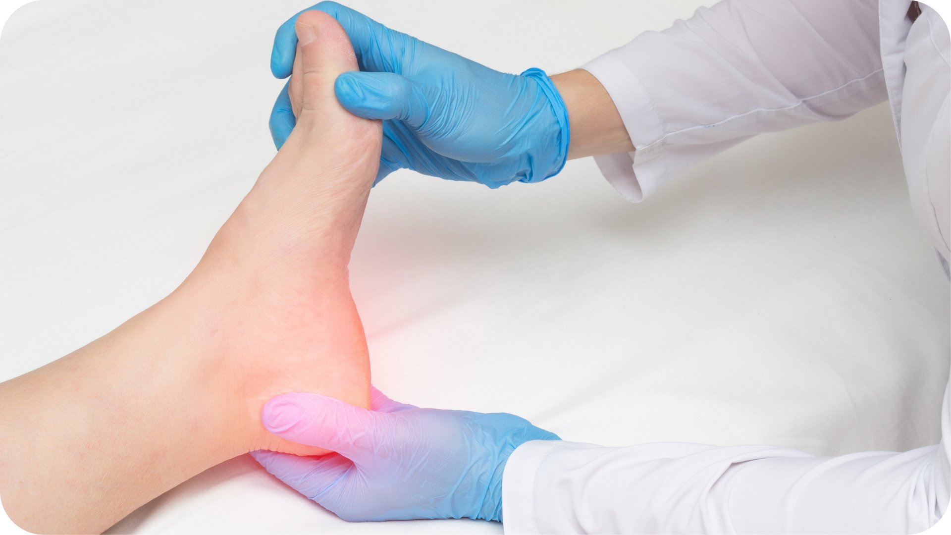 Topuk Dikeni İçin Bitkisel Yöntemler